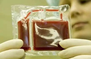 脐带血储存有意义吗？哪些情况储存脐带血更有意义？